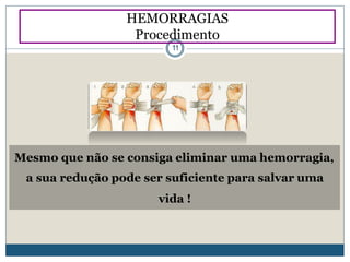 Mesmo que não se consiga eliminar uma hemorragia,
a sua redução pode ser suficiente para salvar uma
vida !
HEMORRAGIAS
Procedimento
11
 