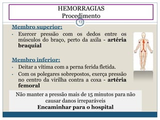 Membro superior:
• Exercer pressão com os dedos entre os
músculos do braço, perto da axila - artéria
braquial
Membro inferior:
• Deitar a vítima com a perna ferida fletida.
• Com os polegares sobrepostos, exerça pressão
no centro da virilha contra a coxa - artéria
femoral
Não manter a pressão mais de 15 minutos para não
causar danos irreparáveis
Encaminhar para o hospital
HEMORRAGIAS
Procedimento
13
 