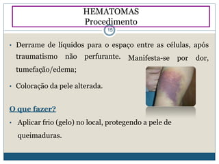 • Derrame de líquidos para o espaço entre as células, após
Manifesta-se por dor,traumatismo não perfurante.
tumefação/edema;
• Coloração da pele alterada.
O que fazer?
• Aplicar frio (gelo) no local, protegendo a pele de
queimaduras.
HEMATOMAS
Procedimento
15
 