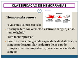CLASSIFICAÇÃO DE HEMORRAGIAS
4
Hemorragia venosa
- o vaso que sangra é a veia
- O sangue tem cor vermelho-escuro (o sangue já não
tem oxigénio)
- Tem menor pressão
- Como as veias têm grande capacidade de distensão, o
sangue pode acumular-se dentro delas e pode
romper uma veia importante, provocando a saída de
sangue.
 