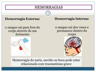 Hemorragia Interna:
o sangue sai dos vasos e
permanece dentro do
corpo
Hemorragia do nariz, ouvido ou boca pode estar
relacionada com traumatismo grave
Hemorragia Externa:
o sangue sai para fora do
corpo através de um
ferimento
HEMORRAGIAS
6
 