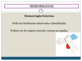 Hemorragia Externa:
Pode ser facilmente observada e identificada.
Podem ser de origem arterial, venosa ou capilar.
HEMORRAGIAS
7
 