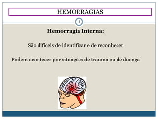 Hemorragia Interna:
São difíceis de identificar e de reconhecer
Podem acontecer por situações de trauma ou de doença
HEMORRAGIAS
8
 