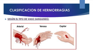 CLASIFICACION DE HERMORRAGIAS
 SEGÚN EL TIPO DE VASO SANGUINEO:
 