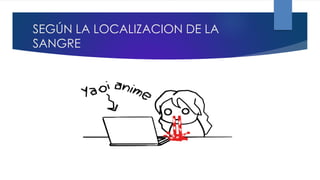 SEGÚN LA LOCALIZACION DE LA
SANGRE
 