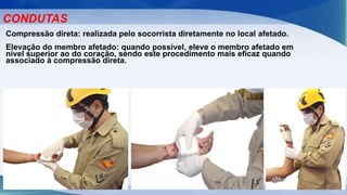 CONDUTAS
Compressão direta: realizada pelo socorrista diretamente no local afetado.
Elevação do membro afetado: quando possível, eleve o membro afetado em
nível superior ao do coração, sendo este procedimento mais eficaz quando
associado à compressão direta.
 