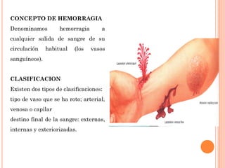 TRATAMIENTO DE HEMORRAGIAS clínicas y enfermeria | PDF