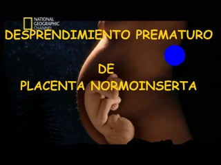 DESPRENDIMIENTO PREMATURO  DE  PLACENTA NORMOINSERTA 