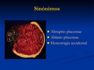 Sinónimos Abruptio placentae Ablatio placentae Hemorragia accidental 