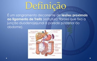 Definição
É um sangramento decorrente de lesões proximais
ao ligamento de Treitz (estrutura fibrosa que fixa a
junção duodenojejunal à parede posterior do
abdome).
 