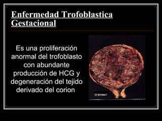 Enfermedad Trofoblastica Gestacional Es una proliferación anormal del trofoblasto con abundante producción de HCG y degeneración del tejido derivado del corion  