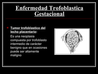 Enfermedad Trofoblastica Gestacional Tumor trofoblastico del lecho placentario : Es una neoplasia compuesta por trofoblasto intermedio de carácter benigno que en ocasiones puede ser altamente maligno 