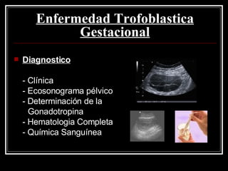Enfermedad Trofoblastica Gestacional Diagnostico - Clínica  - Ecosonograma pélvico - Determinación de la  Gonadotropina - Hematologia Completa - Química Sanguínea 
