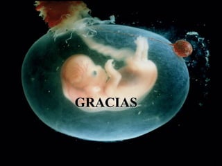 GRACIAS 