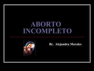 ABORTO INCOMPLETO Br.  Alejandra Morales 