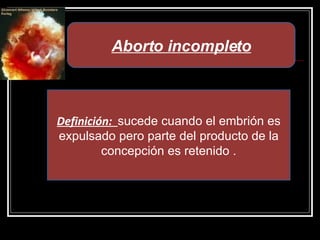 Aborto incompleto Definición:  sucede cuando el embrión es expulsado pero parte del producto de la concepción es retenido . 