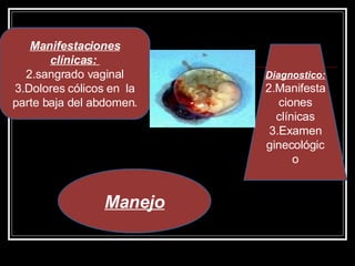 Manifestaciones clínicas:  sangrado vaginal Dolores cólicos en  la parte baja del abdomen . Diagnostico: Manifestaciones clínicas Examen ginecológico Manejo 