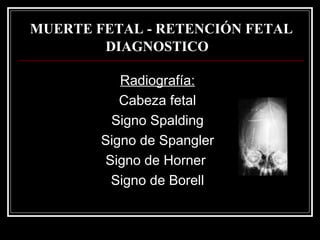 MUERTE FETAL - RETENCIÓN FETAL DIAGNOSTICO   Radiografía : Cabeza  fetal Signo  Spalding Signo de Spangler Signo de Horner  Signo de Borell 