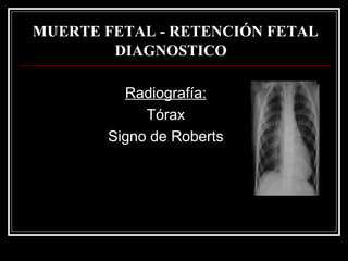 MUERTE FETAL - RETENCIÓN FETAL DIAGNOSTICO   Radiografía: Tórax Signo de Roberts 
