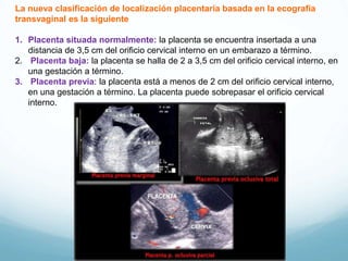 La nueva clasificación de localización placentaria basada en la ecografía
transvaginal es la siguiente
1. Placenta situada normalmente: la placenta se encuentra insertada a una
distancia de 3,5 cm del orificio cervical interno en un embarazo a término.
2. Placenta baja: la placenta se halla de 2 a 3,5 cm del orificio cervical interno, en
una gestación a término.
3. Placenta previa: la placenta está a menos de 2 cm del orificio cervical interno,
en una gestación a término. La placenta puede sobrepasar el orificio cervical
interno.
 