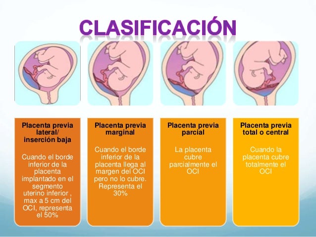 Hemorragias en la segunda mitad del embarazo