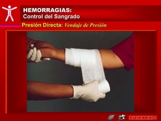 HEMORRAGIAS:
Control del Sangrado
Presión Directa: Vendaje de Presión
 