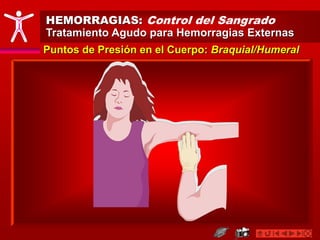 HEMORRAGIAS: Control del Sangrado
Tratamiento Agudo para Hemorragias Externas
Puntos de Presión en el Cuerpo: Braquial/Humeral
 