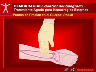 HEMORRAGIAS: Control del Sangrado
Tratamiento Agudo para Hemorragias Externas
Puntos de Presión en el Cuerpo: Radial
 
