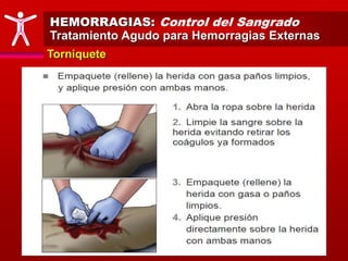 HEMORRAGIAS: Control del Sangrado
Tratamiento Agudo para Hemorragias Externas
Torniquete
 