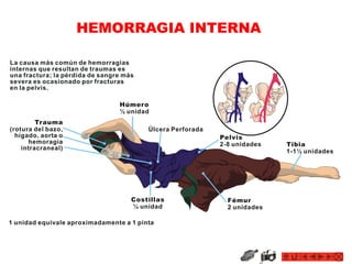 HEMORRAGIA INTERNA
 