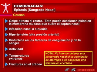 HEMORRAGIAS:
Epitaxis (Sangrado Nasal)
Causas
Golpe directo al rostro. Esto puede ocasionar lesión en
la membrana mucosa que cubre el septun nasal
Hipertensión (alta presión arterial)
Fracturas en el cráneo
Disturbios en los factores de coagulación y de la
sangre
Infección nasal o sinusitis
NOTA: No intentar detener una
hemoragia nasal si se acompaña
de otorragia o se sospecha una
fractura en el cráneo
Actividad
Temperaturas
extremas
 