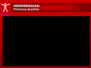 HEMORRAGIAS:
Primeros Auxilios
 