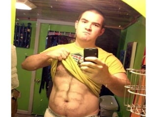 Hemorragias 1er trimestre