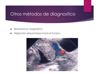 Otros métodos de diagnostico
 Resonancia magnetica
 Migración placentaria hacia el fundus.
 
