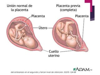 PLACENTA PREVIA
Definición
Es la complicación obstétrica
consistente en la implantación anormal
placentaria
la cual ocurre...