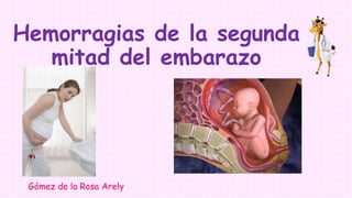 Hemorragias de la segunda
mitad del embarazo
Gómez de la Rosa Arely
 