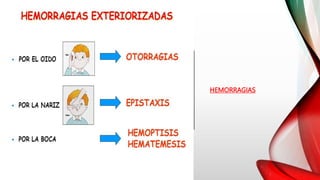 HEMORRAGIAS
 