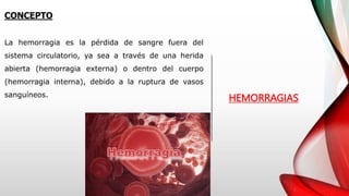 HEMORRAGIAS
La hemorragia es la pérdida de sangre fuera del
sistema circulatorio, ya sea a través de una herida
abierta (hemorragia externa) o dentro del cuerpo
(hemorragia interna), debido a la ruptura de vasos
sanguíneos.
CONCEPTO
 