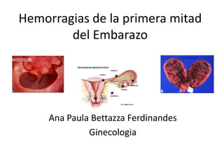 Hemorragias de la primera mitad
del Embarazo
Ana Paula Bettazza Ferdinandes
Ginecologia
 