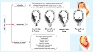 Anomalía en la placentación ….. adherencia anormalmente fija de la placenta a la pared
uterina.
Acretismo Placentario
Defi...
