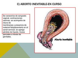 C) ABORTO INEVITABLE-EN CURSO


Se caraceriza de sangrado
vaginal, contracciones
uterinas, se acompaña de
rotura de
membranas y presencia de
material fetoplacentario en el
canal cervical, se agrega
pérdida de líquido, trozos
parciales a través de
genitales.
 
