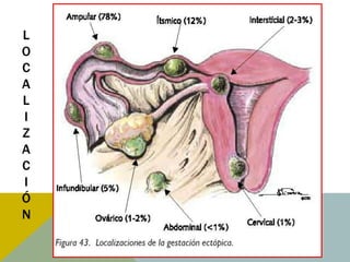 L
O
C
A
L
I
Z
A
C
I
Ó
N
 