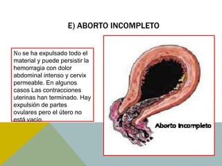 E) ABORTO INCOMPLETO


No se ha expulsado todo el
material y puede persistir la
hemorragia con dolor
abdominal intenso y cervix
permeable. En algunos
casos Las contracciones
uterinas han terminado. Hay
expulsión de partes
ovulares pero el útero no
está vacío.
 