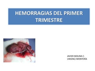 HEMORRAGIAS DEL PRIMER
TRIMESTRE
JAVIER MOLINA C.
UNISINÚ-MONTERÍA
 