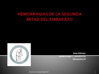 Jose Gómez
GinecologíaY Obstetricia
Semestre XI
Obstetricia Integral Siglo XXI 1
 