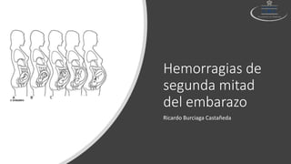 Hemorragias de
segunda mitad
del embarazo
Ricardo Burciaga Castañeda
 