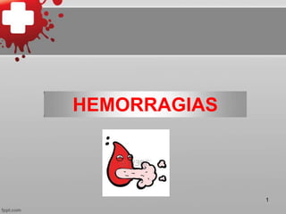 1
HEMORRAGIAS
 