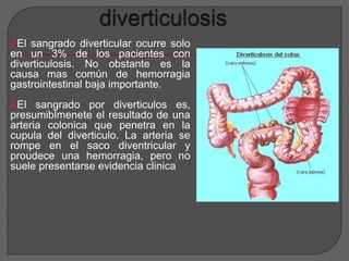 El sangrado diverticular ocurre solo 
en un 3% de los pacientes con 
diverticulosis. No obstante es la 
causa mas común de hemorragia 
gastrointestinal baja importante. 
El sangrado por diverticulos es, 
presumiblmenete el resultado de una 
arteria colonica que penetra en la 
cupula del diverticulo. La arteria se 
rompe en el saco diventricular y 
proudece una hemorragia, pero no 
suele presentarse evidencia clinica 
 