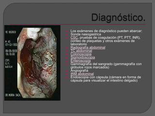 Los exámenes de diagnóstico pueden abarcar: 
 Sonda nasogastrica 
 CSC, pruebas de coagulación (PT, PTT, INR), 
conteo de plaquetas y otros exámenes de 
laboratorio 
 Radiografía abdominal 
 TC abdominal 
 Colonoscopia 
 Sigmoidoscopia 
 Enteroscopia 
 Gammagrafía del sangrado (gammagrafía con 
glóbulos rojos marcados) 
 Angiografía 
 IRM abdominal 
 Endoscopia con cápsula (cámara en forma de 
cápsula para visualizar el intestino delgado) 
 
