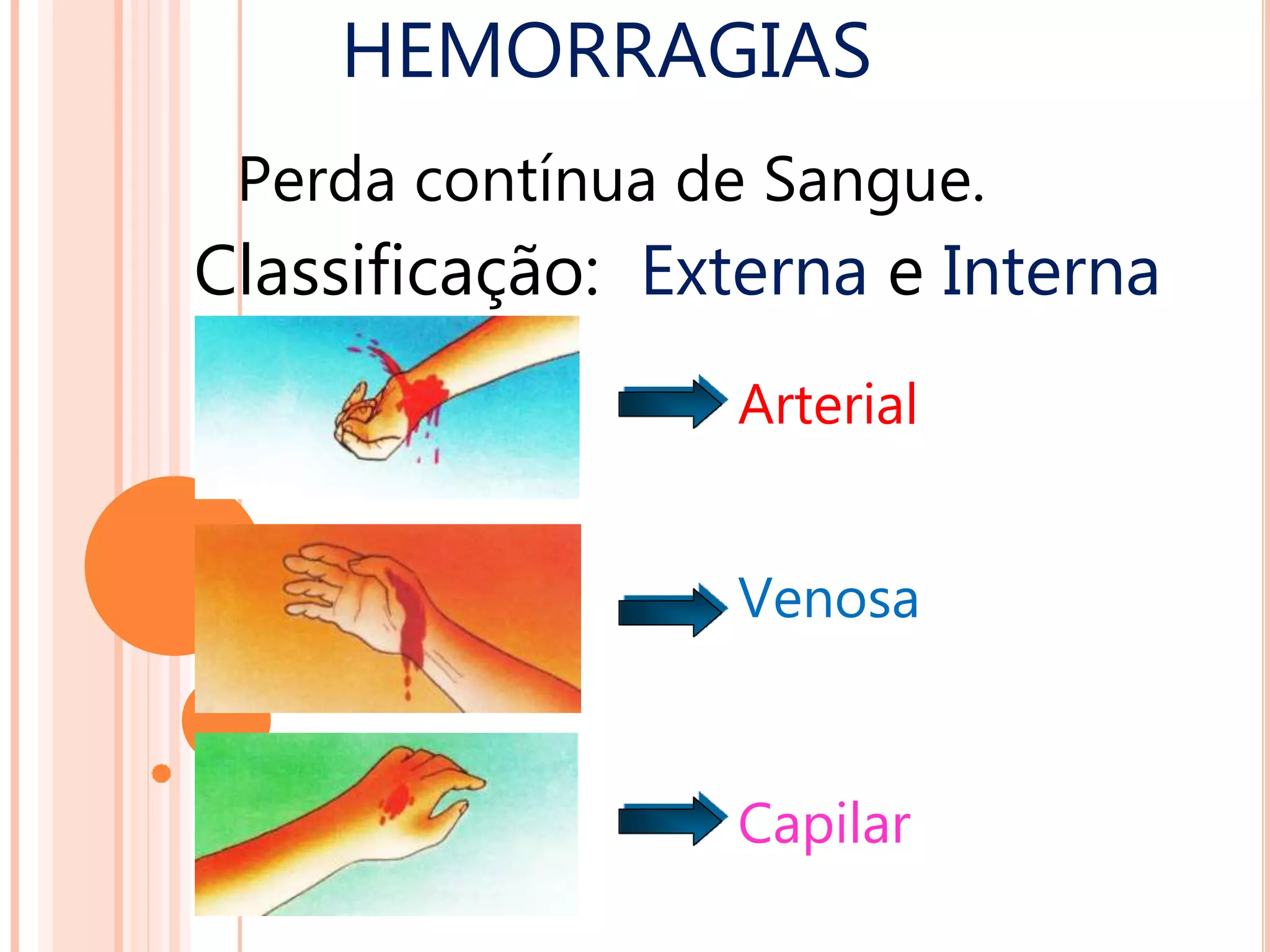 Hemorragias e ferimentos | PPTX